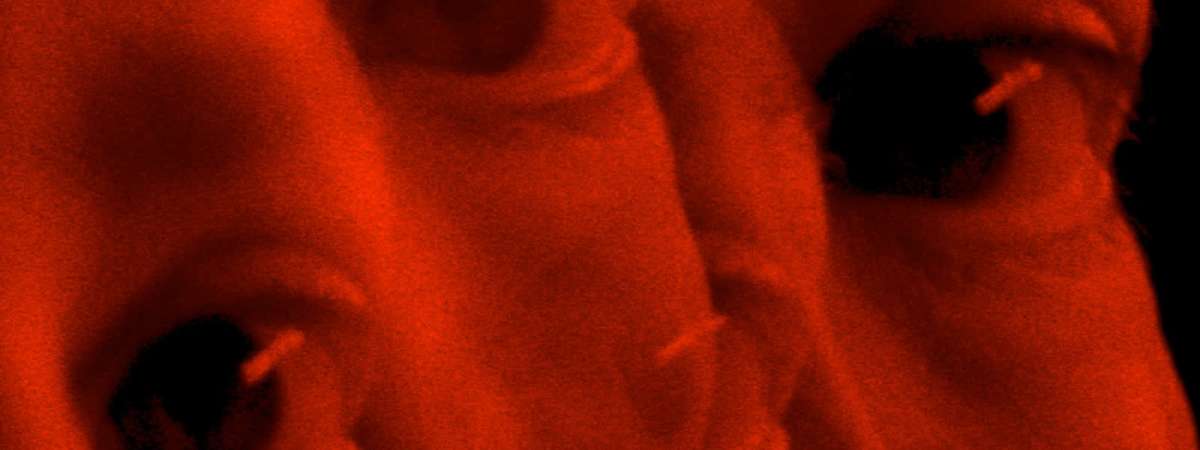 Short Forum 9: Big Time Sensuality VIFF Short Forum
Image: Vulnus